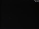 03 : 20