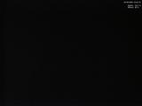03 : 44