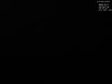 00 : 36
